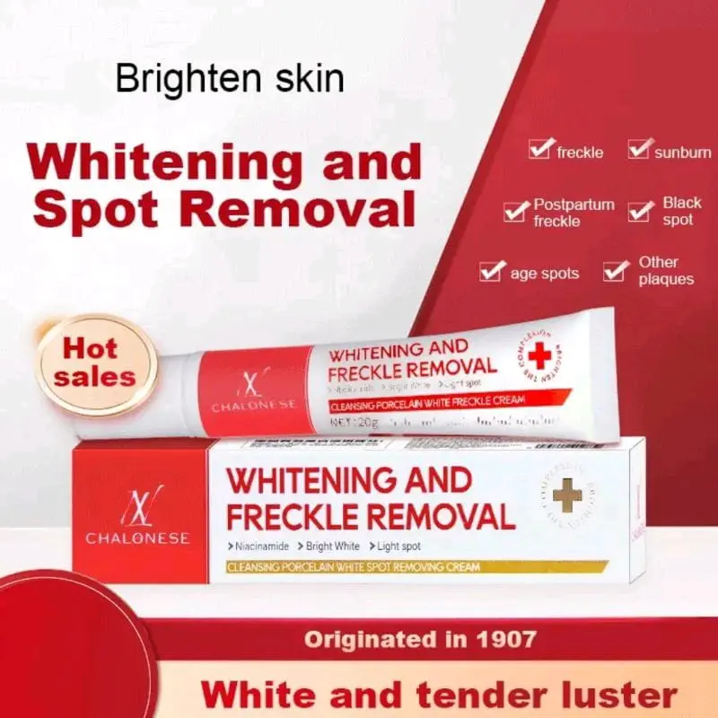 CHALONESE Cream whitening and freckle removing memutihkan memudarkan noda hitam