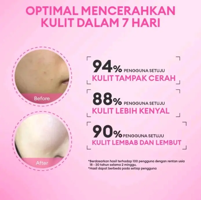 serum animate 5X active whitening facial mencerahkan 5x lebih cerah skincare untuk bopeng brightening Pencerah Wajah Niacinamide Hydrating Hitam Aging chierra anti flek glad2 glow 7
