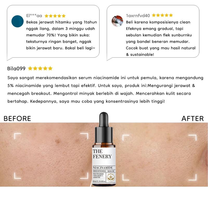 The Fenery Niacinamide Brightening Serum 20ml Essence Aging Wajah. Mencerahkan Kusam Hitam Acid Memutihkan Hyaluronic Pembersihan Vitamin Perawatan Extract Memudarkan 4