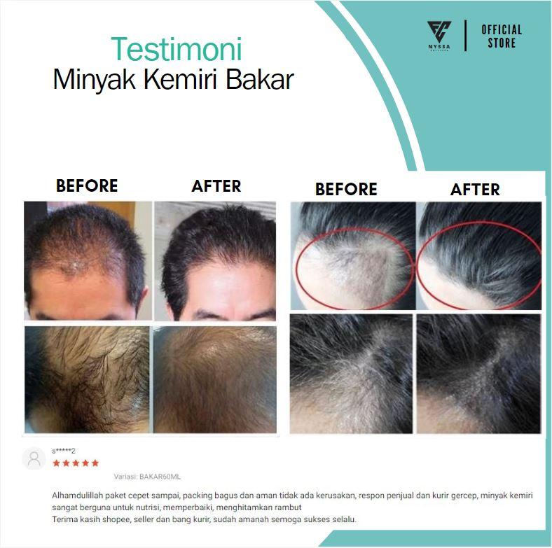 NYSSA Minyak Kemiri Bakar Penumbuh Rambut Botak Rontok - Alis - Jenggot 100% Asli Kemiri Original 4