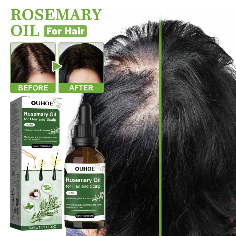 OUHOE Rosemary Oil Hair Growth Oil Minyak Penumbuh Rambut 50ml 1