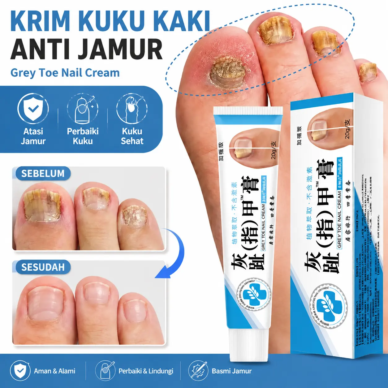 Perawatan Kuku Berjamur Grey Toe Nail Cream 20g Krim Lembut Untuk Memperbaiki Kuku Menguning Menebal