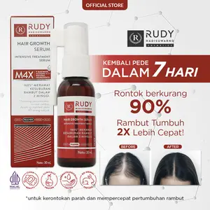Rudy Hadisuwarno Cosmetics Hair Growth Serum 30 ml Hair Serum Penumbuh Rambut Serum Rambut Penumbuh Rambut Botak Vitamin Rambut Haircare Hair Treatment Anti Hair Fall Serum Anti Hair Fall Treatment Hair Growth Hair Grow