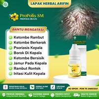 Gambar Propolis SM Brazil Obat Atasi Ketombe Berkerak Psoriasis Borok di Kepala dari Lapak Herbal Arifin Kota Administrasi Jakarta Barat 1 Tokopedia