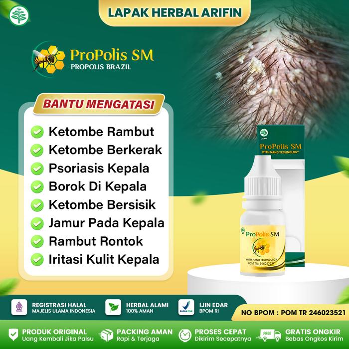 Gambar Propolis SM Brazil Obat Atasi Ketombe Berkerak Psoriasis Borok di Kepala dari Lapak Herbal Arifin Kota Administrasi Jakarta Barat Tokopedia