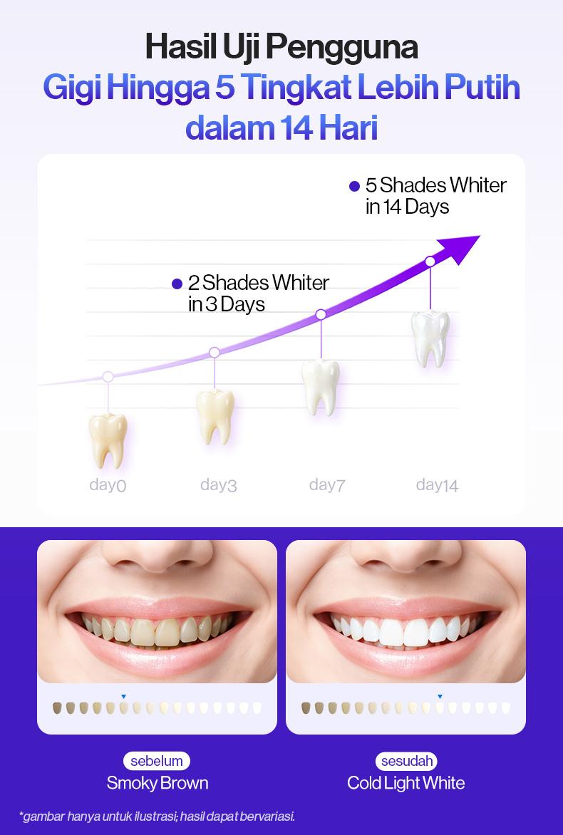 [Ultimate White Trio] usmile Pasta Gigi Optical White 100gr + Fresh White 110gr (Varian Random) + Repair White 100gr + Fresh White 30gr | Purple Whitening Tooth Paste | Menetralisir Noda Kuning Pada Gigi | Memutihkan & Mencerahkan