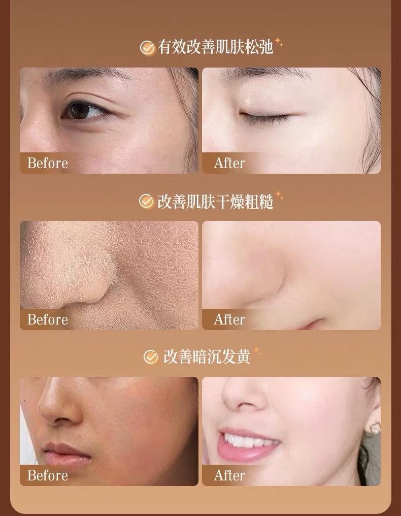 Product Introduction of VSHELL Black tea rose wash-free sleep mask nicotinamide hydrating moisturizing soothing anti-oxidation staying up late brightening applying frozen film. Moisture Skincare Gel Moisturizer Moisturize Hydrate Skin Repair Comfort 6