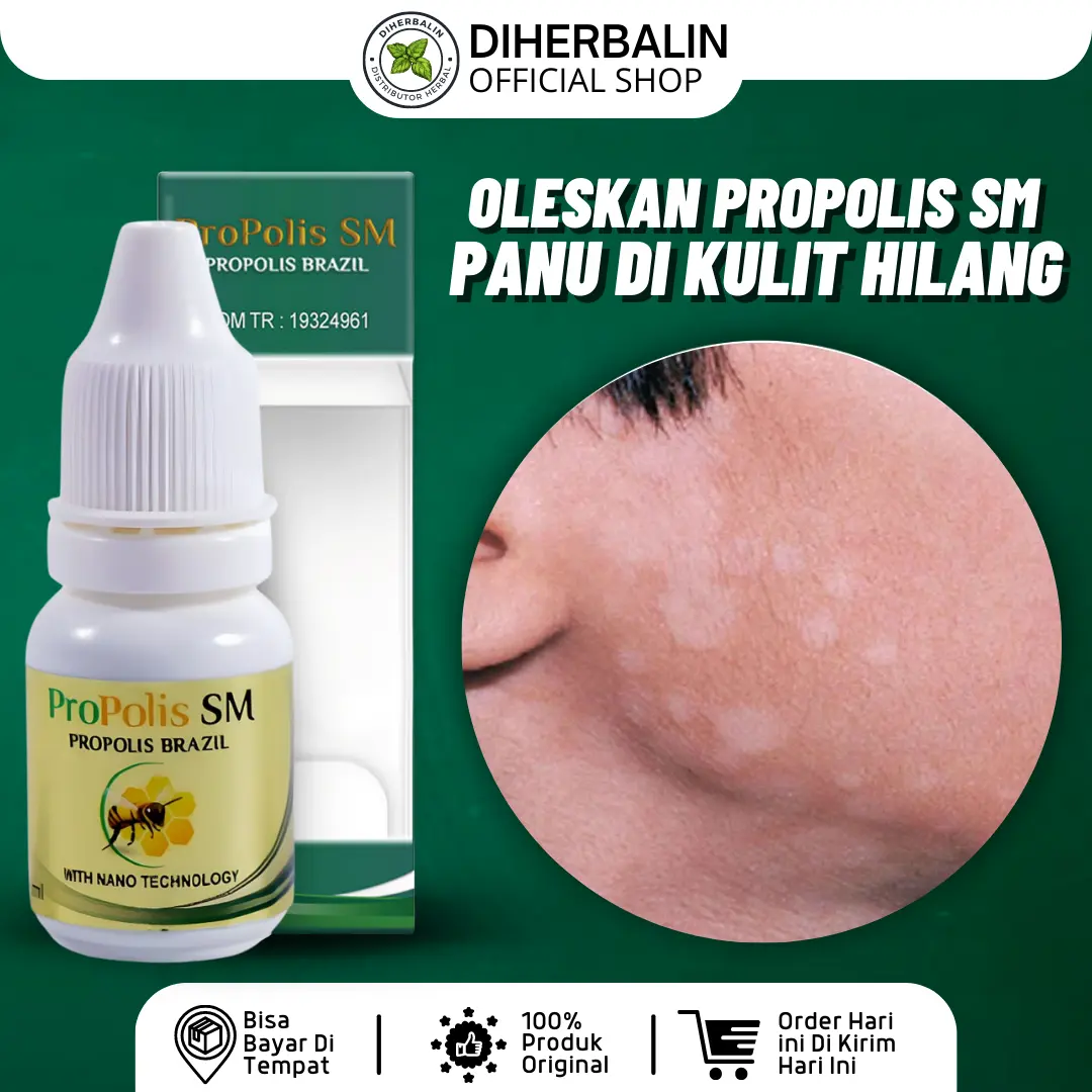 Propolis SM Obat Panu Jamur Kulit Becak Putih 6ml