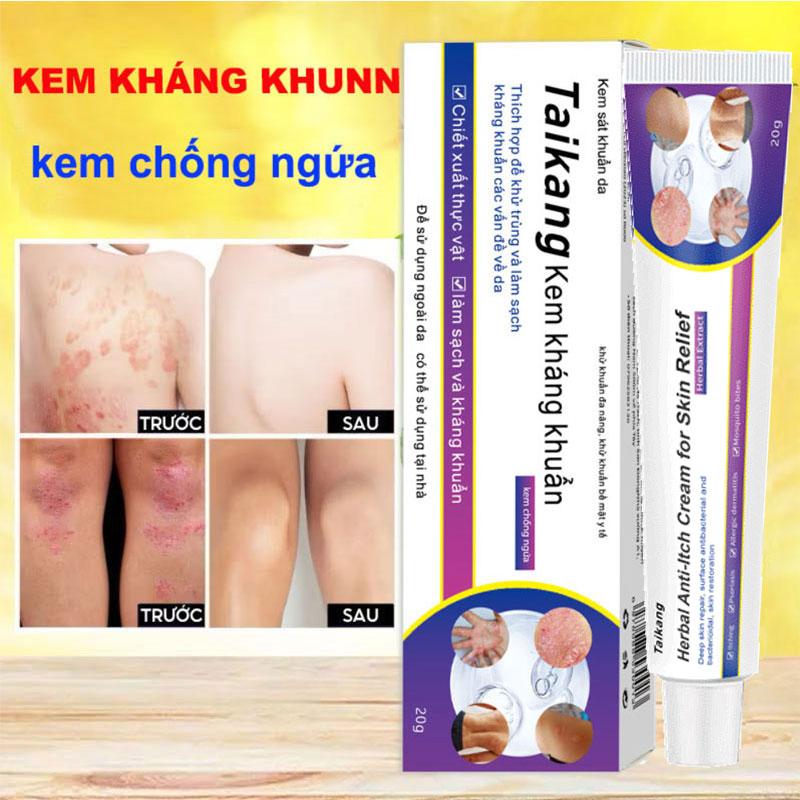 Taikang bôi nấm ngứa Kem bôi nấm ngứa Thuốc ngứa Viêm da cơ Địa hắc Lào lang ben Trị nấm da Đầu thuốc Trị chàm Viêm nang Kem trị ngứa Tác dụng nhanh
