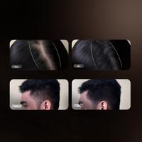 Gambar FIBRATIN Optimizer Alat Bantu Meratakan Hair Filler Secara Rapih dari Fibratin Indonesia Kota Administrasi Jakarta Pusat 5 Tokopedia