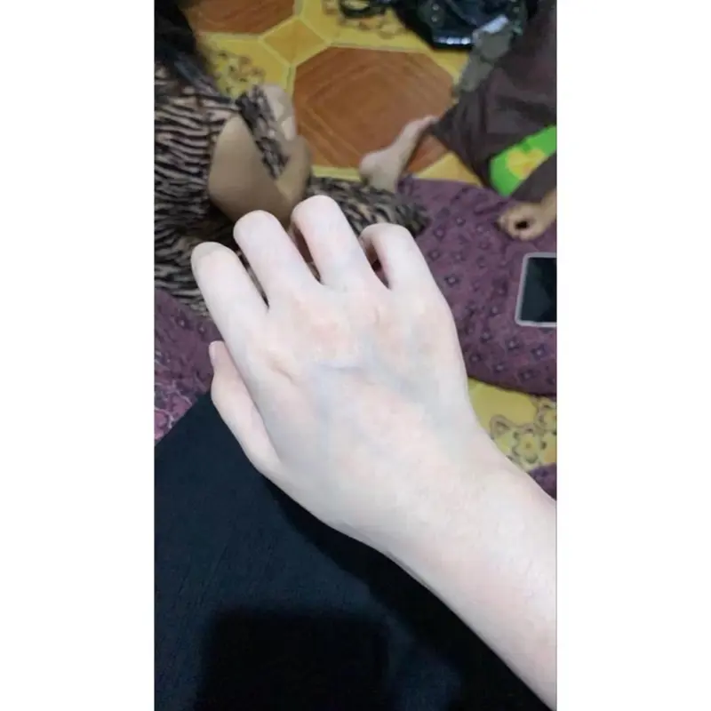 SALMON DNA SUYO Semua Jenis Kulit BPOM AMAN BUMIL BUSUI 7