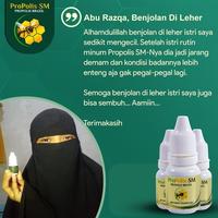 Gambar ProPolis SM Obat Kista Ganglion Benjolan Di Tangan dari Diherbalin Shop Kota Administrasi Jakarta Barat 3 Tokopedia