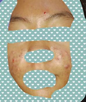 Product Review of Scarlett Whitening Face Care Bundle Series Perawatan Wajah - Brightly Series | Acne Series | Age Delay Series from 𝓭**🩹 1