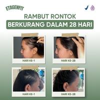 Gambar Etagenfit Paket 2 Box Susu Etawa Plus Kolagen I & Sarang Burung Walet Premium Untuk Perawatan Alami Harian dari Etagenfit Kab. Cirebon 5 Tokopedia