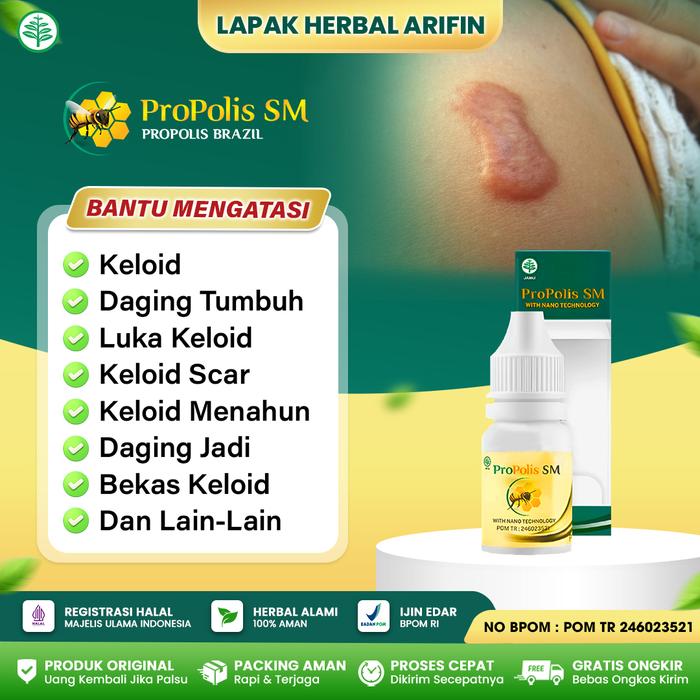 Gambar Propolis SM Obat Keloid Bekas Luka tindik daging tumbuh Luka Jahitan dari Lapak Herbal Arifin Kota Administrasi Jakarta Barat Tokopedia