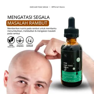 [ADs] 10X Lebih Cepat dan Ampuh Mengatasi Kebotakan Pada Rambut - Ever Hair Serum Paket 1 Botol - Rambut Cepat Tumbuh Tebal dan Sehat