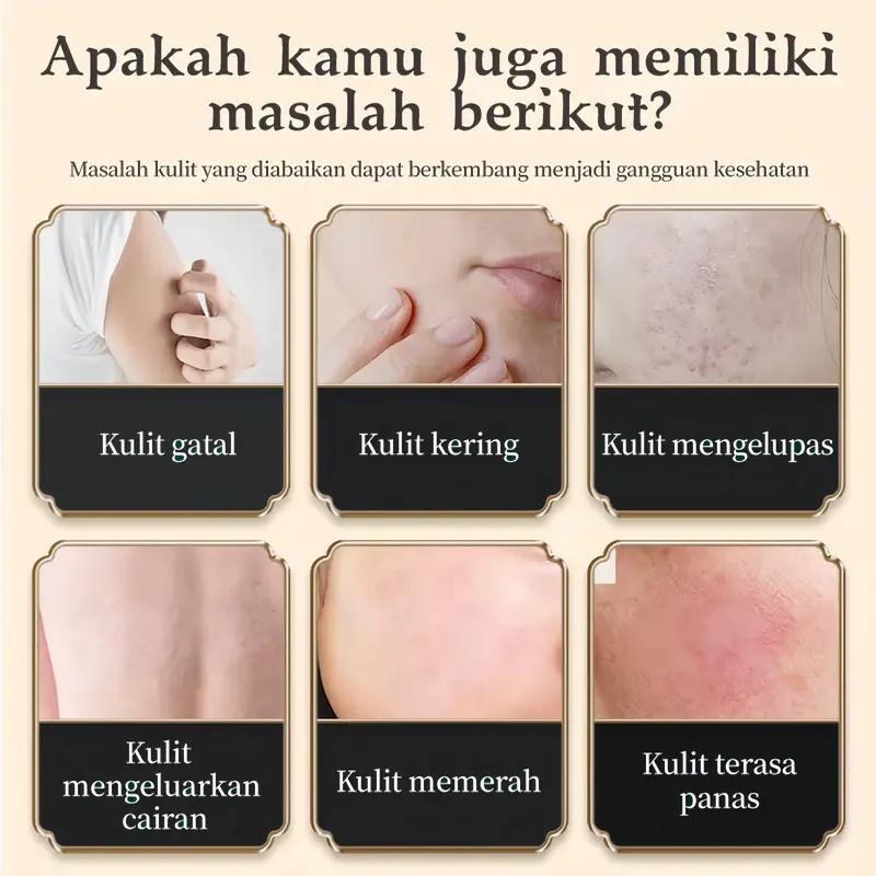 Dr.YuTitan Krim Gatal Kulit – Skin Soothing Cream untuk Area Sensitif & Nyaman