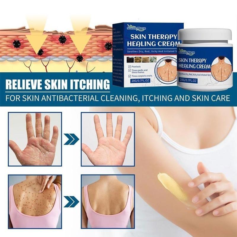 Product Introduction of South Moon Salep Khusus Psoriasis - psoriasis ointment - Kurap Pada Kulit Kepala - Kutu Air - Kurap Pada Badan - Eksim - Infeksi Kulit - Obat Luar Mengatasi Gatal 20g Perawatan Tubuh Kering Pembersihan 4