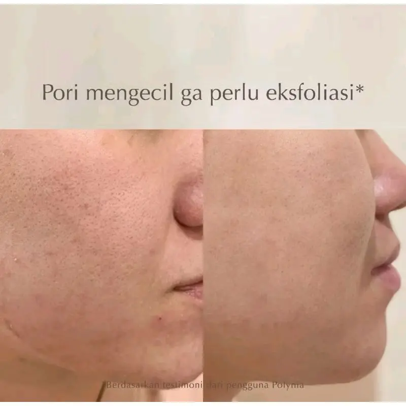 POLYNIA Prickly Pear Hydrating Face Mask Wajah Hyaluronic Masker Aging Penyegar Acid Ceramide Ceramide Kering 2
