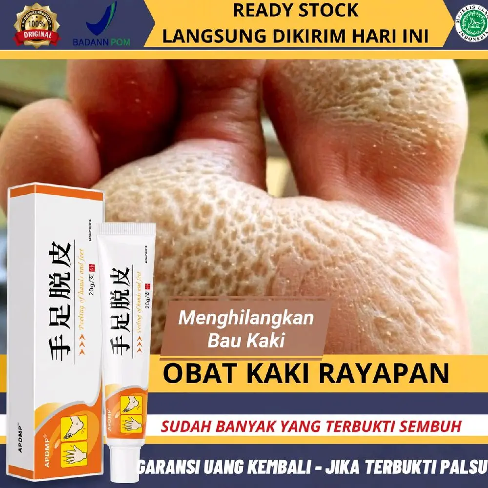 Obat Kaki Rayapan/ Bau Penghilang Bau Kaki Obat Jamur Kaki Obat Kaki Jamuran Pembersih Kulit Mati Kaki Obat Kaki Bolong Salep Gatal Kaki Paling Ampuh Krim  kaki gradakan