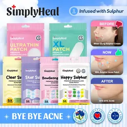 SimplyHeal Sulphur Patch | Day & Night Premium Hydrocolloid Acne Patch | Pimples Treatment with Sulphur, Cica & Tea Tree Oil | Penampalan Jerawat