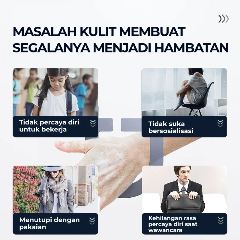 Kreain Krim Perbaikan Eksim Memperbaiki kulit eksim yang gatal, kemerahan, dan bercak putih Meredakan gatal-gatal Menghilangkan rasa gatal Melembapkan dan menutrisi kulit 2