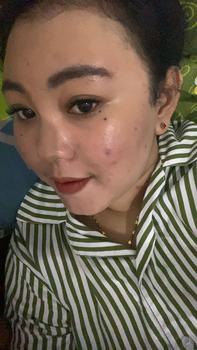 Product Review of DOSIS 2 ACNE - Paket Acne Ectoin+ Extra [for your Acne Treatment] from U**i 0