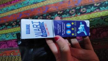 Product Review of Penghilang Kutil Wart Remover Skin Tag Remover Penghilang Tahi lalat Salep Penghilang Flek Hitam Perawatan from -**ر س**- 0
