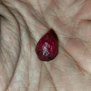 Batu cincin unik tetes meteor merah ori Delima