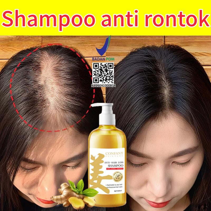 Shampoo rambut rontok Shampoo penumbuh rambut cepat Sampo pemanjang rambut dengan cepat Shampo jahe Meningkatkan pertumbuhan rambut dan mencegah rambut ront - Beli 2 Gratis 1