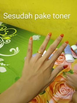 Product Review of PAKET 2 TONER BADAN MARLENA DNA SALMON BODY TONER MARLENA BPOM from N**l A** K**g 3