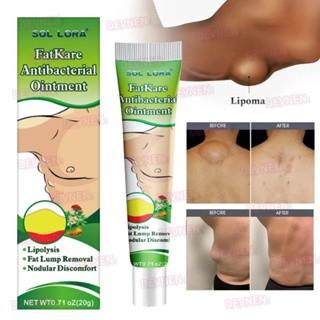 Product Introduction of sumifun lipoma solusi ampun menghilangkan benjolan 2