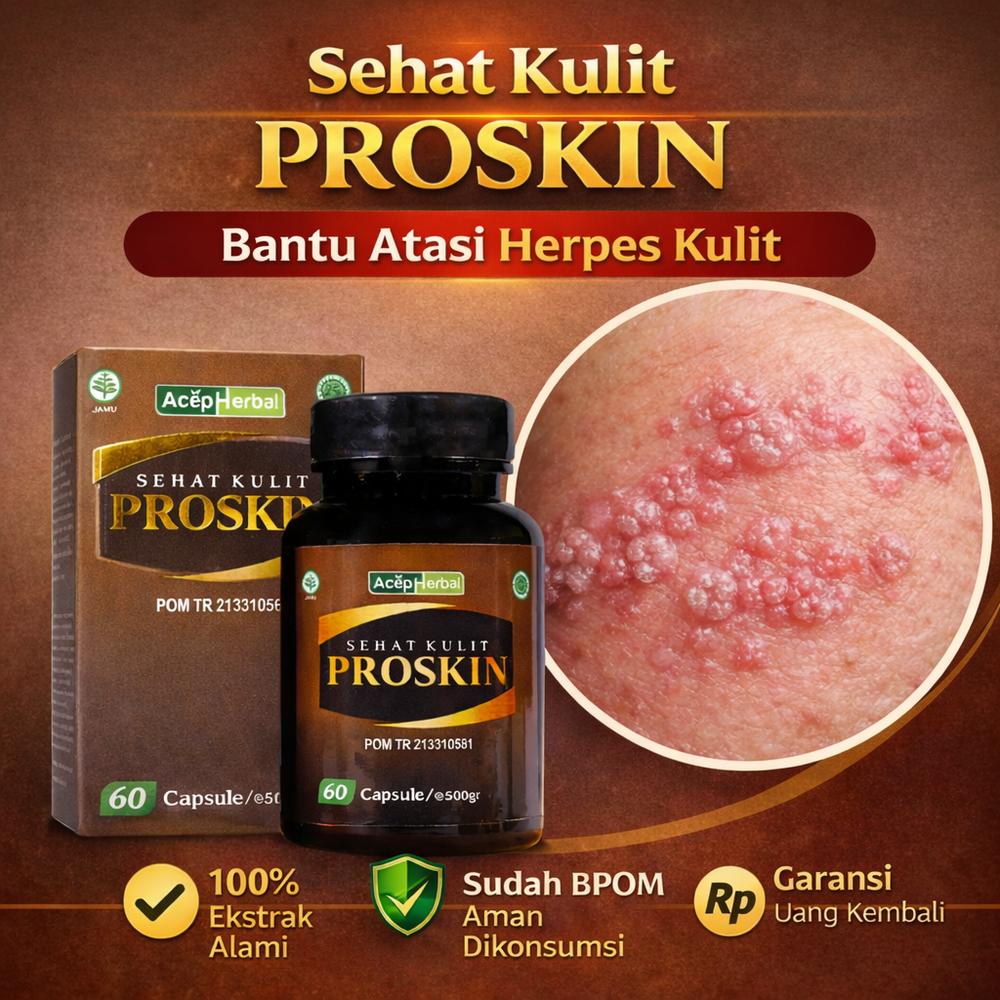 Proskin Kapsul | Bantu Atasi Herpes Kulit & Herpes Simpleks