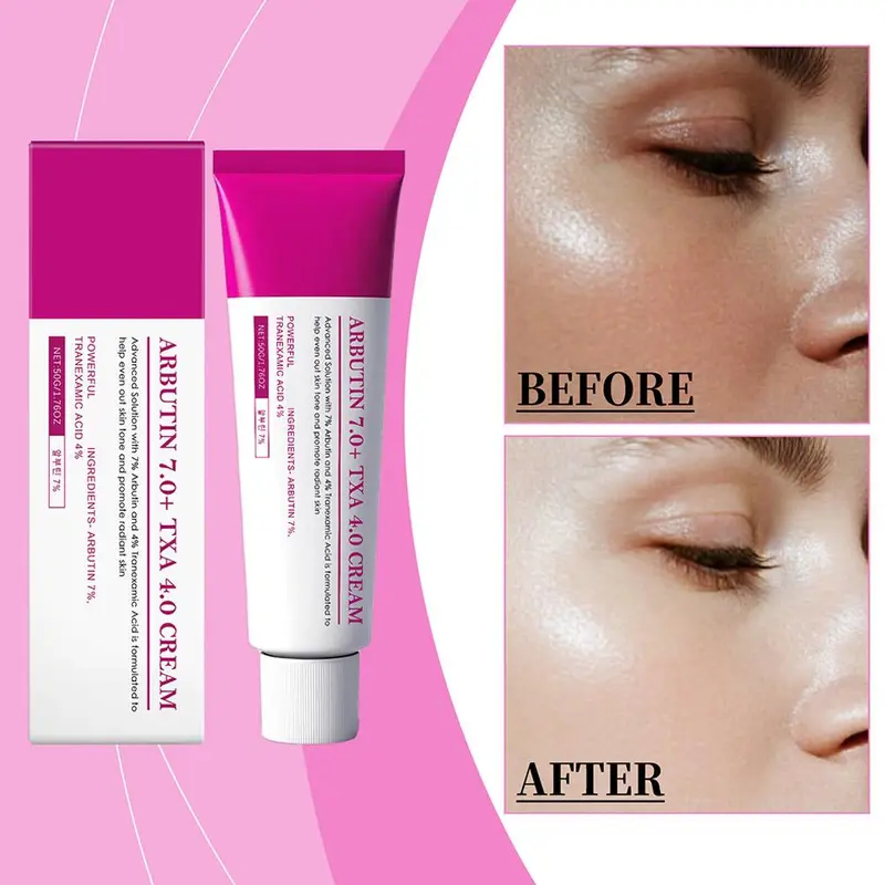 buy 1 take 1Arbutin 7% + Tranexamic Acid 4% Whitening Dark Spot Cream  Niacinamide Glutathione Hydrating Brightening Face Cream - TikTok Shop  Philippines