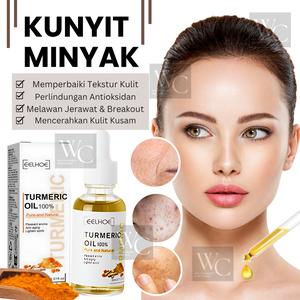 30ml Minyak Kunyit Organik Cerah Kulit Lembap Muka Kawal Jerawat Parut Gelap Redakan Kemerahan Kunyit Natural Turmeric Essential Oil Serum Face Body Skin Brightening Moisturizing Glow Reduce Pores Wrinkles Lightening Anti Acne Skin Corrector Cares Serum