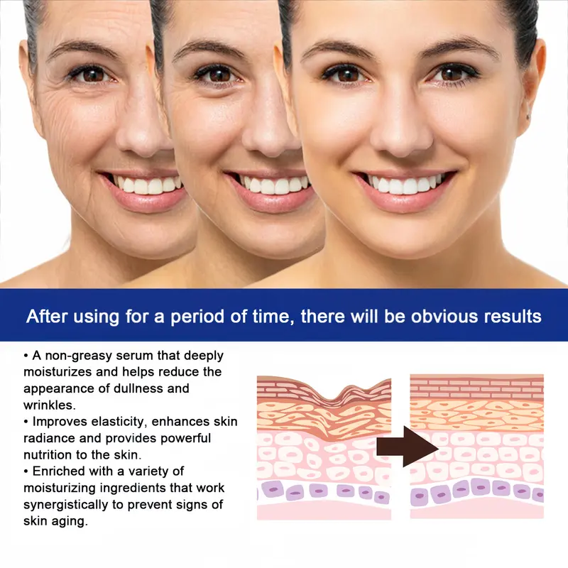 EELHOE Botox Stock Solution Facial Serum, Botox Stock Anti-Aging Serum, Promotes Skin Collagen, Reduces Fine Lines, Wrinkles, Plumps Skin 5