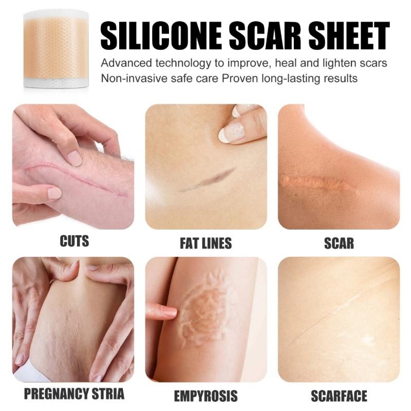 ⭐️ORI⭐️ELAIMEI Silicone Scar Sheets Patch Penghilang Keloid Tambalan Stretch Mark Surgery Scar Removal Silicone Repair Tape 4cm x 1.5m - Ready 5