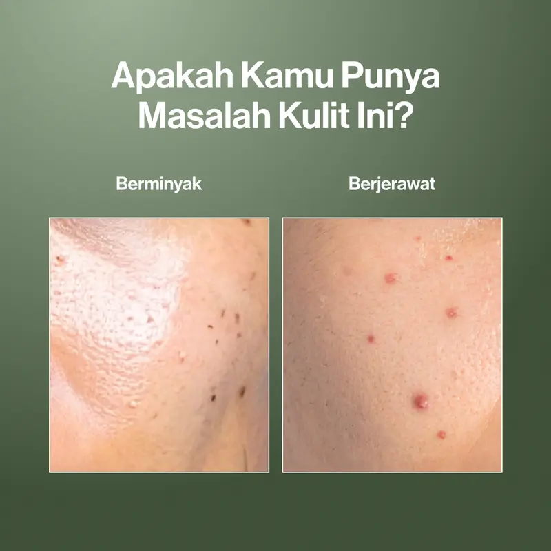 Kahf Face Wash Oil and Acne Care 100 ml - Sabun Cuci Muka Pria untuk Membantu Lawan Jerawat dan Kontrol Minyak - Suitable for Daily Use 5
