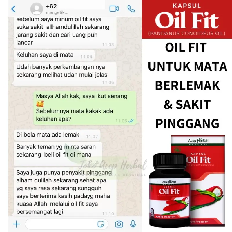 Oilfit Kapsul Herbal Mata Berlemak / Mata Kuning Penyakit Glukoma Pterygium 3