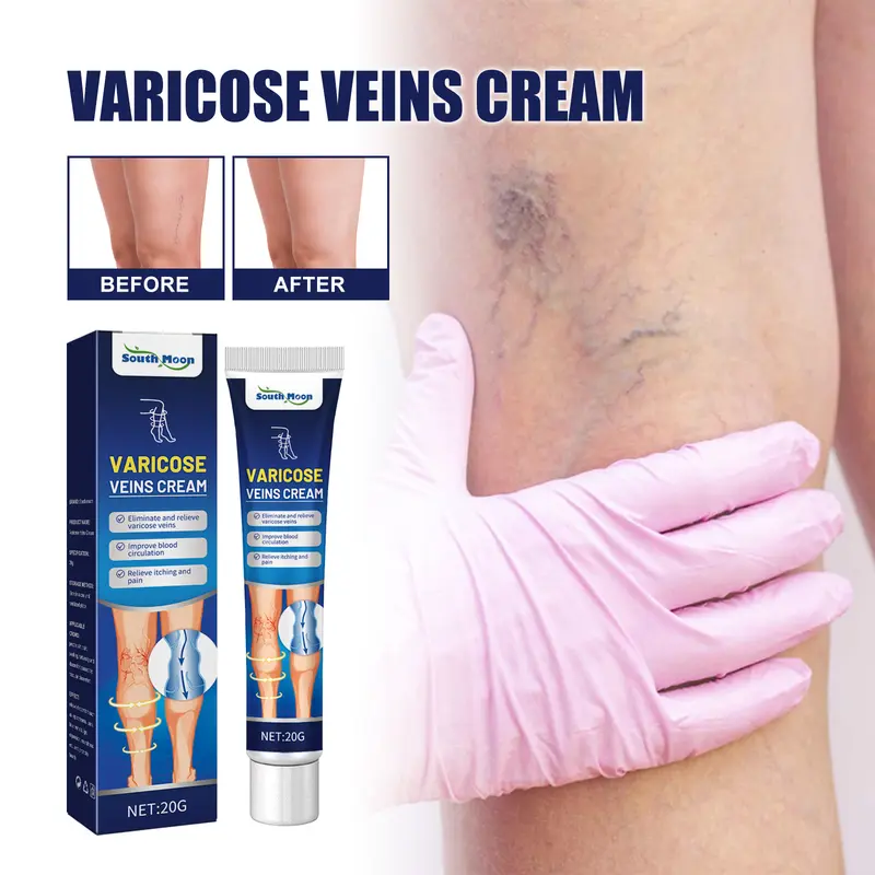 South Moon Pijat Vena Varises Krim Perbaikan Kaki Cacing Tanah Meringankan Vena Varises yang Menonjol di Kaki Extract Ceramide 0