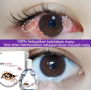 { BISA COD } Obat TETES Mata. Obat Mata KERING - 13 ml