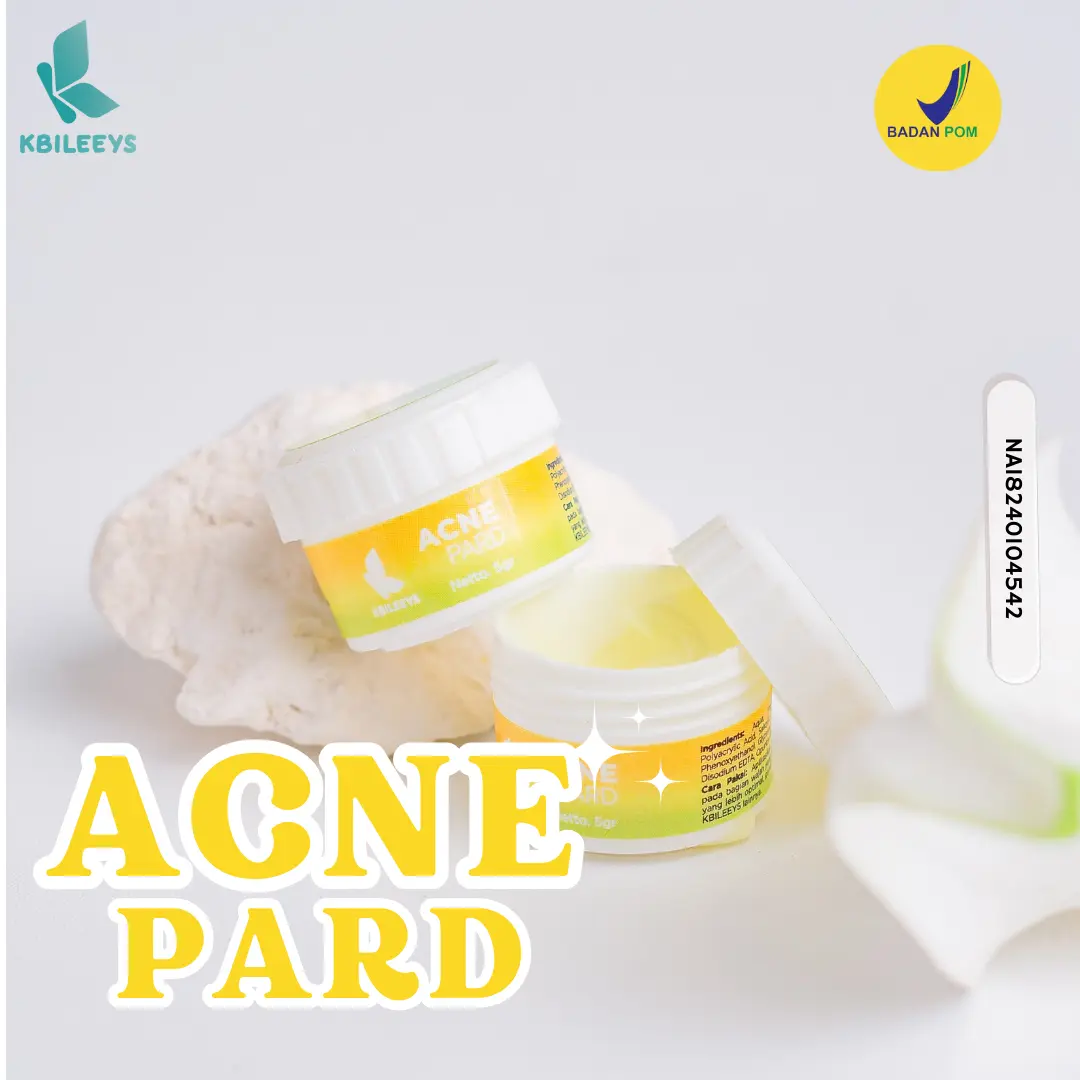 KBILEEYS ACNE PARD TOTOL JERAWAT/ACNE CREAM UNTUK KULIT JERAWAT