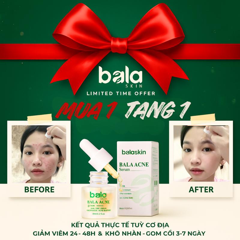 Mua 1 tặng 1 SERUM TRỊ MỤN BALA SKIN – GIẢM VIÊM NHANH GOM CỒI NHANH AN TOÀN CHO DA NHẠY CẢM