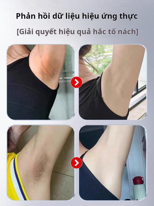 Kem Dưỡng Cải Thiện Sắc Tố Da 30g – Dưỡng Sáng Vùng Nách, Đầu Gối, Khuỷu Tay Với Niacinamide & Chiết Xuất Dâu Tằm – Chăm Sóc Da Toàn Thân 2