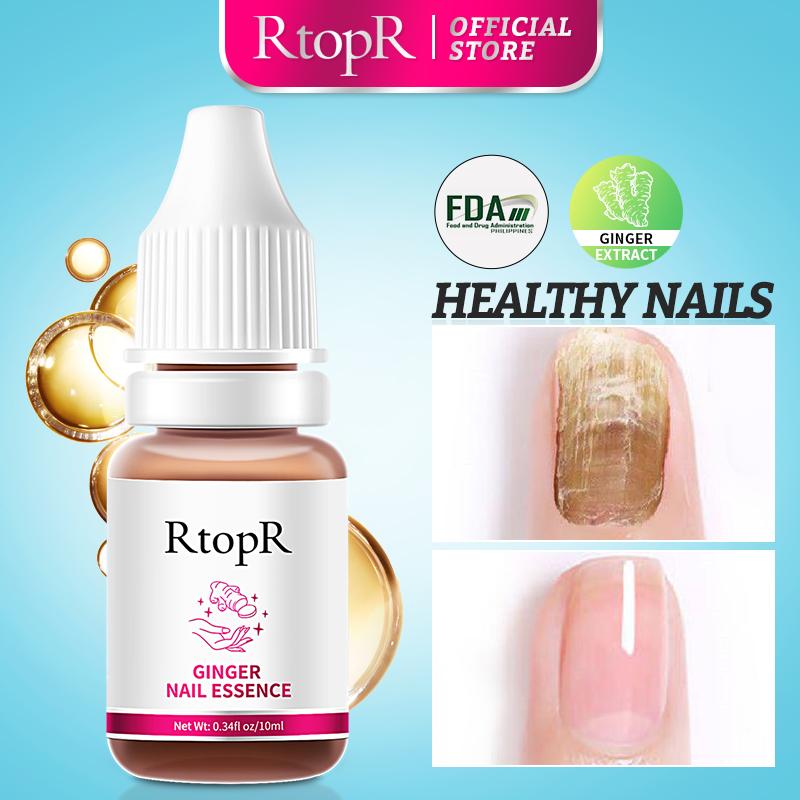 Ginger Nail Repair Essence Healthy nails & restores shine to nails 2