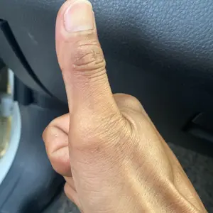 Master Rem Axial & Radial 14Mm Ori Thailand Kanan Kiri & Kanan Bebek Matik Sport Universal Semua motor