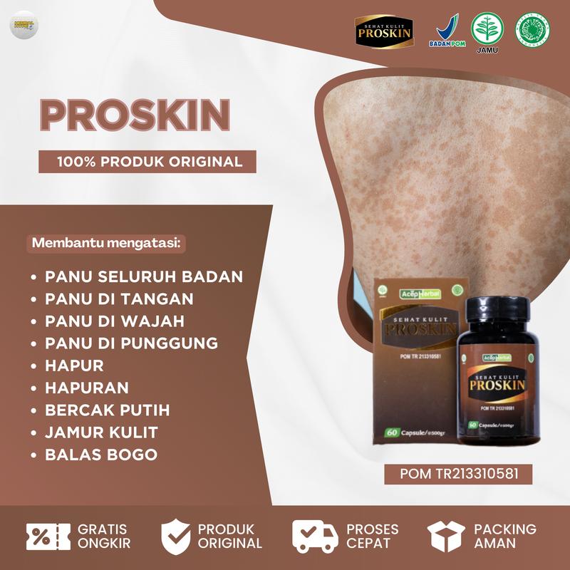 Proskin Kapsul Hapur, Penghilang Panu, Hapuran, Panu Di Badan, Panu Di Punggung, Panu Di Wajah, Panu Di Dada, Panu Di Tubuh, Bercak Putih Di Kulit, Jamur Kulit, Kadas Kudis Kurap Gatal 0