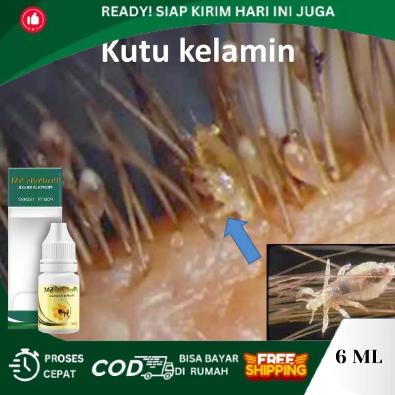 Kutu Kelamin, Kutu Kemaluan Pria Wanita, Tetes Kutu Kelamin, Kutu Kemaluan, Pembasmi Kutu Kemaluan Pria, Kutu Kemaluan Wanita 0