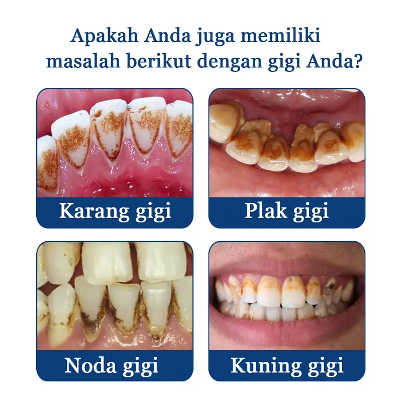 SP7 Pemutih Gigi Pasta Gigi Pemutih Dan Perontok Karang Pemutih Gigi Kuning Berkerak Menghilangkan Bau Mulut【Cod】120gr Memutihkan Pembersihan Perawatan 6