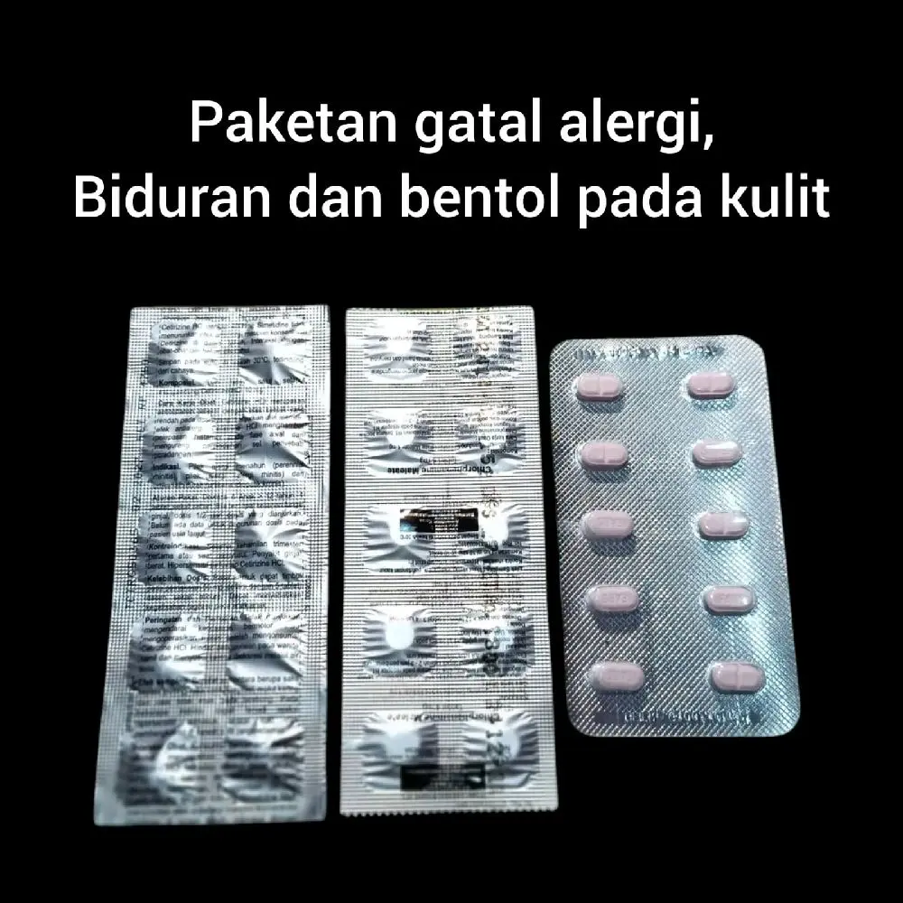 Paketan Gatal Alergi Biduran Bentol pada Kulit Obat untuk Mengatasi Alergi dan Biduran di Kulit
